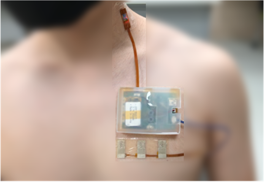 Cardiovascular Monitoring